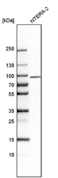 Stonin-1 Antibody, Novus Biologicals 25ul | Buy Online | Novus Biologicals | Fisher Scientific
